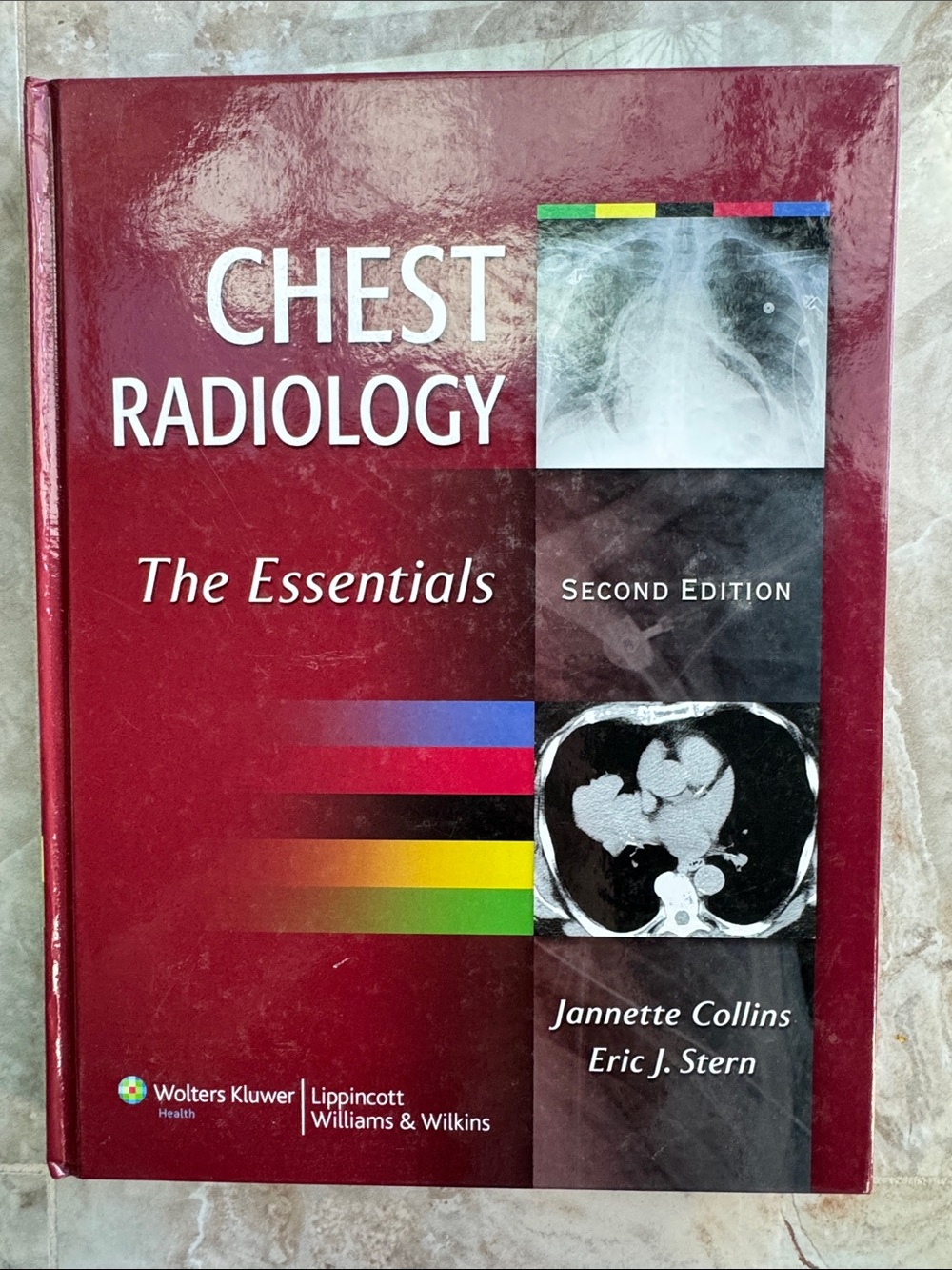 Chest Radiology: The Essentials - Second Edition by Collin’s & Stern